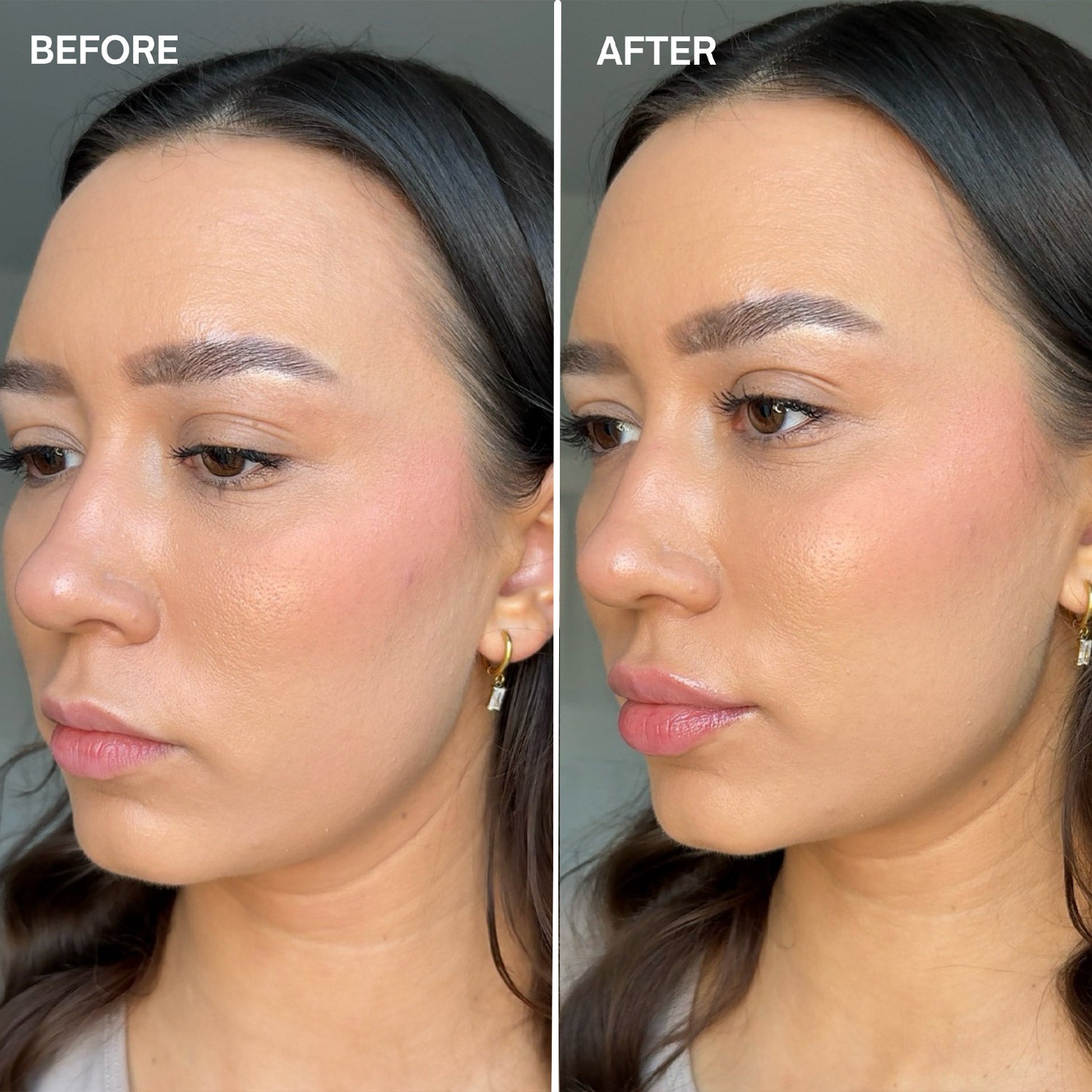 Facefixers Voluptuous Lipvolume Before and After