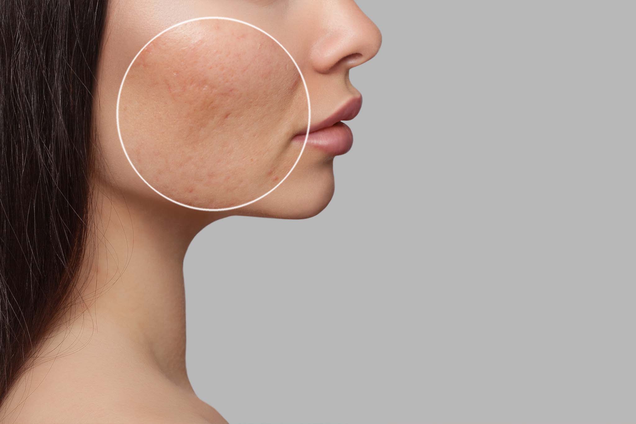 Top 3 tips for hyperpigmentation - Transformulas
