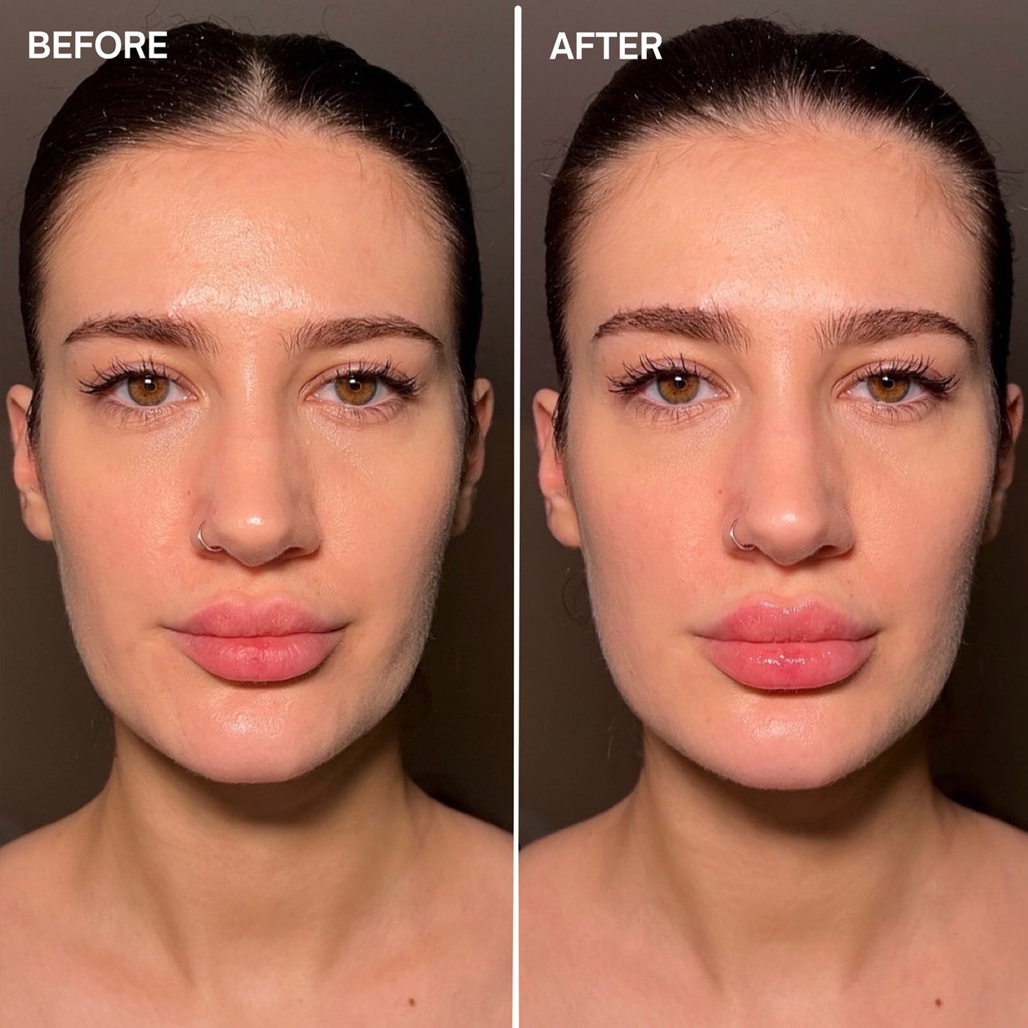 Facefixers Voluptuous Lipvolume Before and After