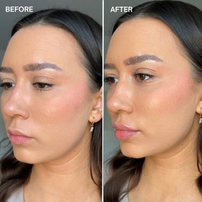 Facefixers Voluptuous Lipvolume Before and After