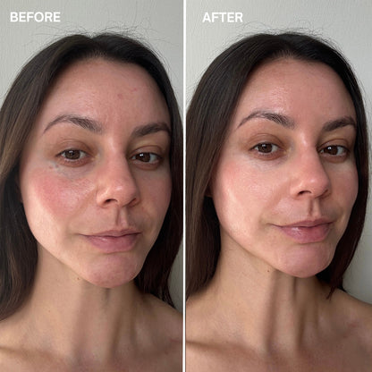 Marine Miracle Creme Before and After