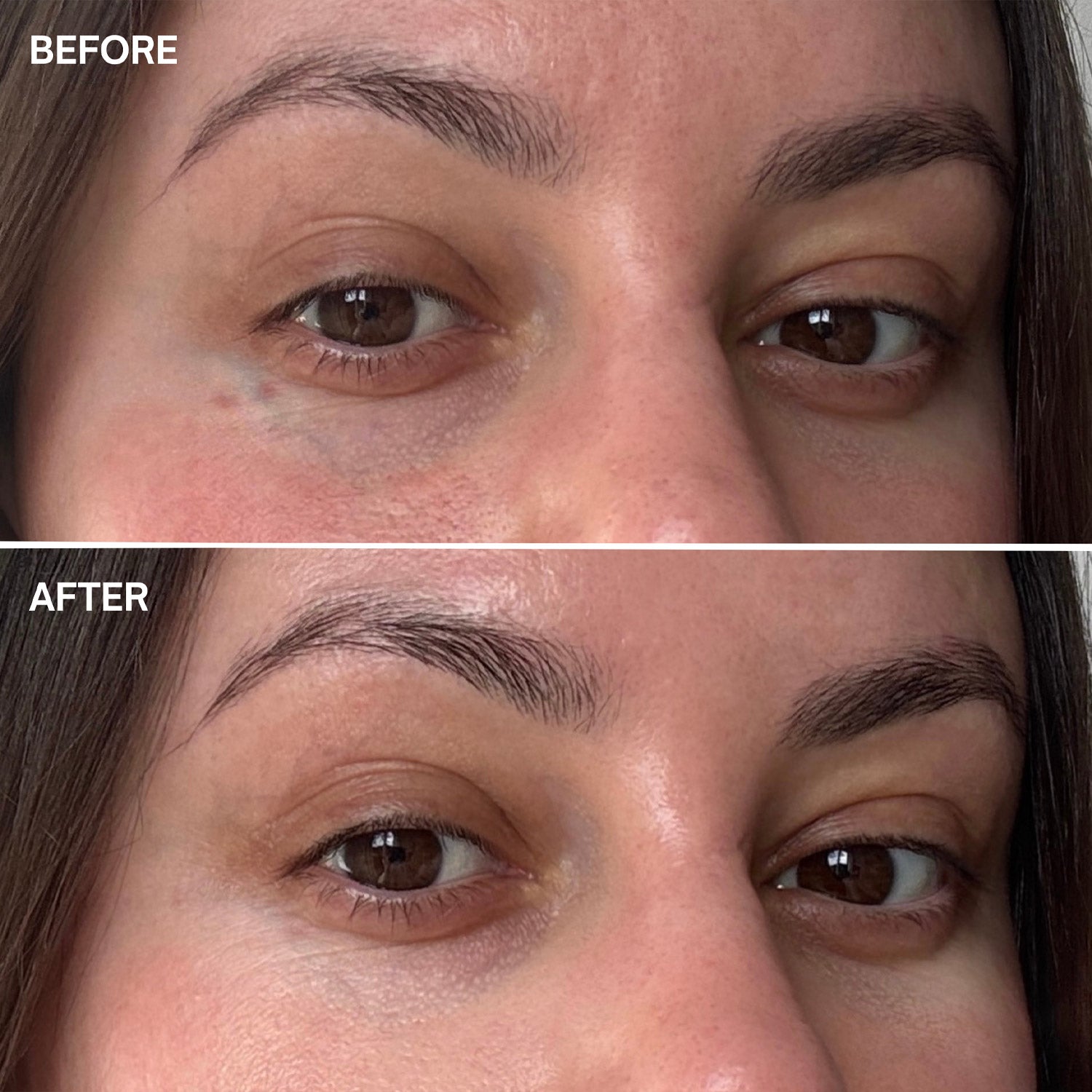 Marine Miracle Eyezone Before and After