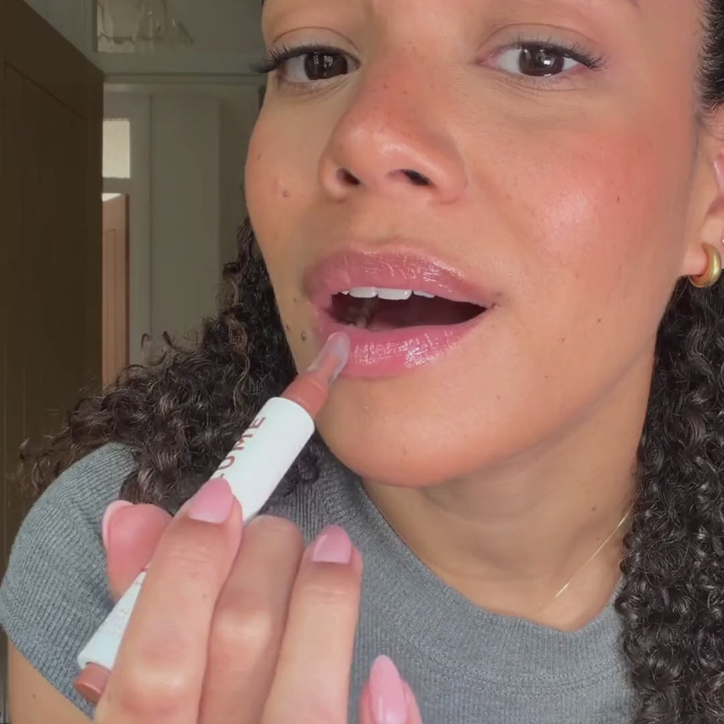 Lipvolume Before and After Video